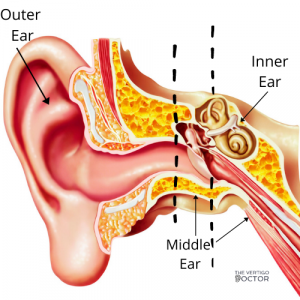 Positional Vertigo (BPPV) FAQs