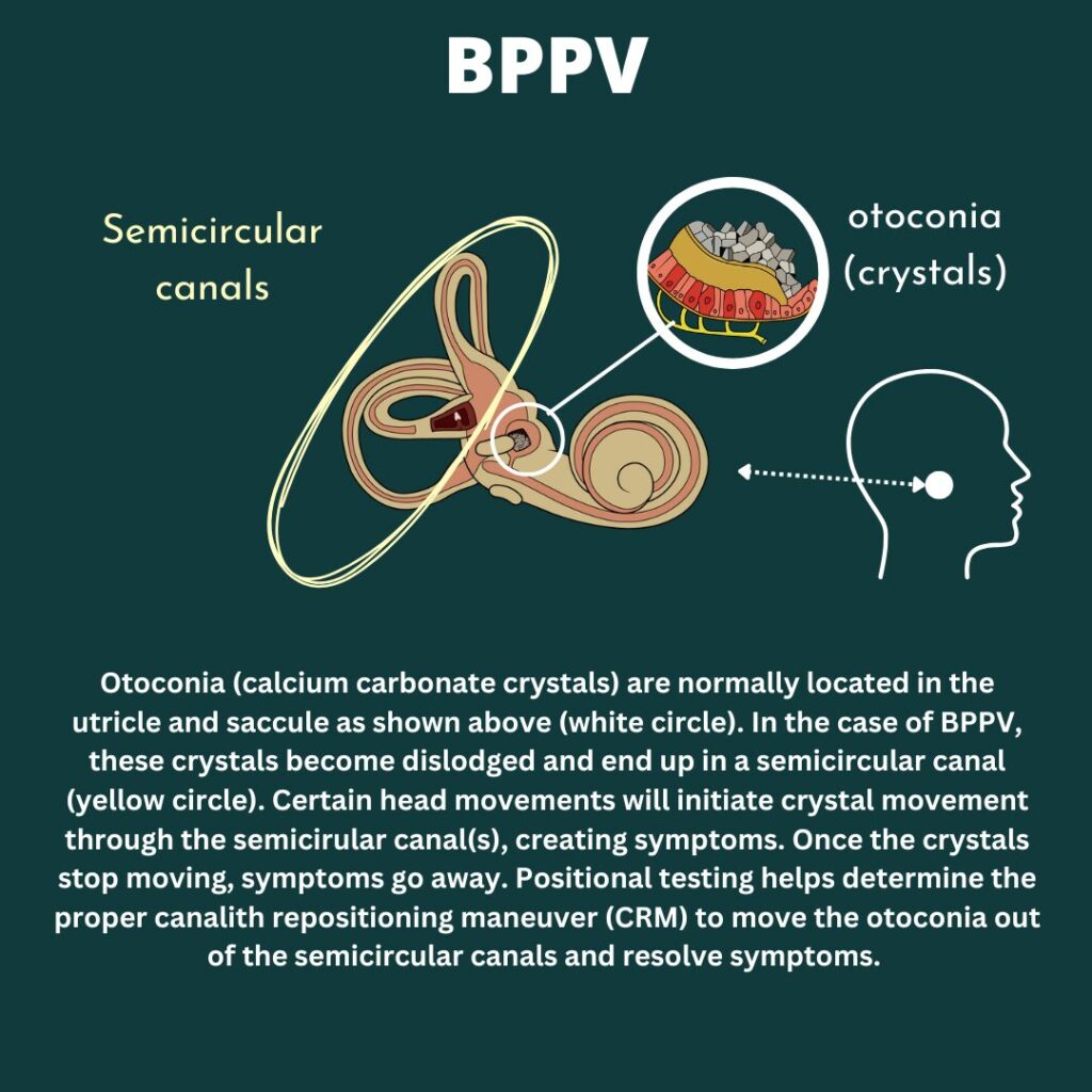 BPPV: Best Treatment Options