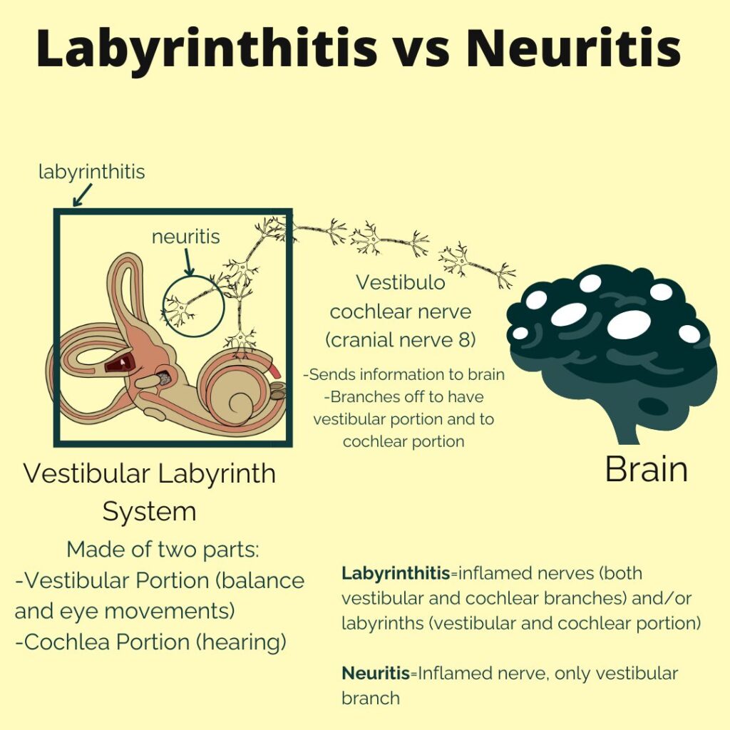 Understanding Neuritis and Labyrinthitis